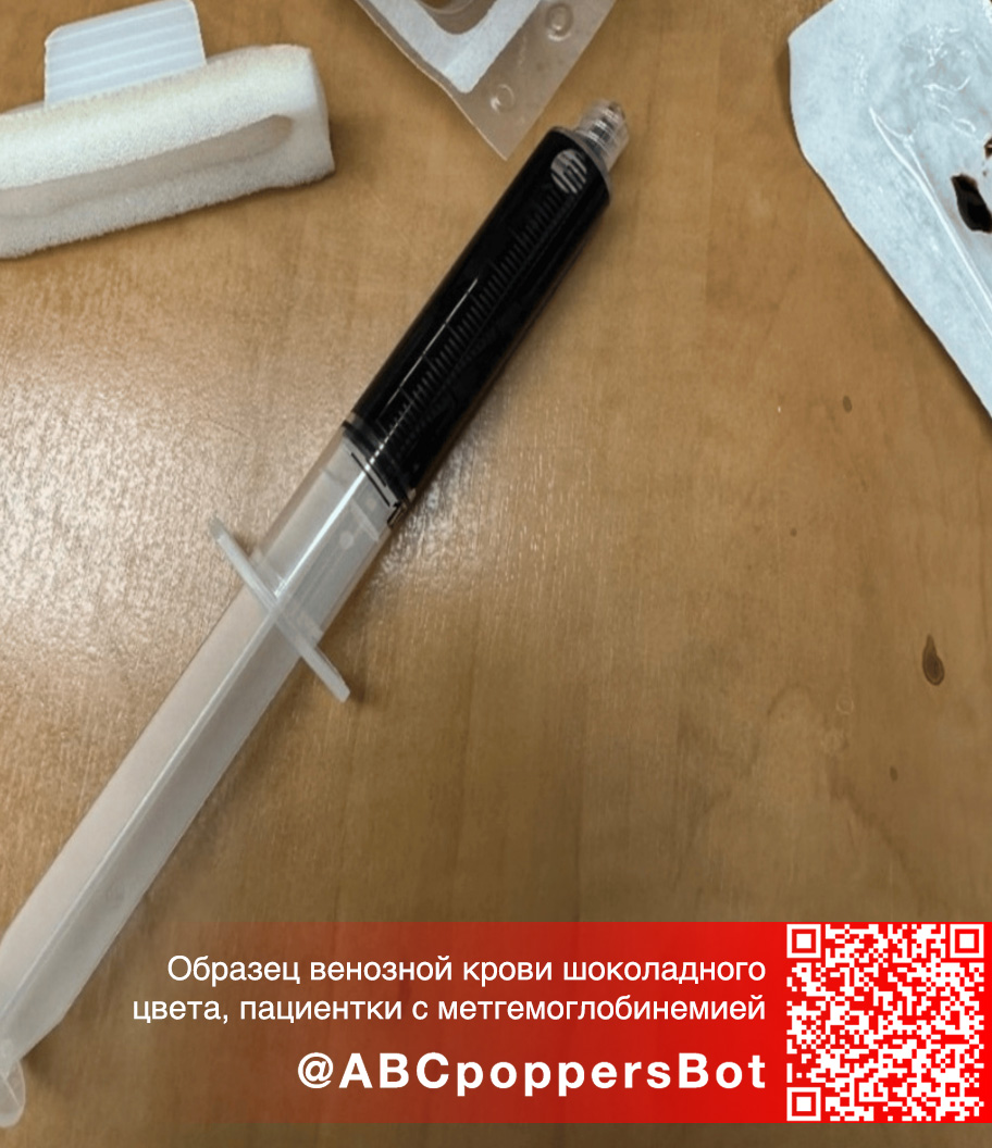 Если принять попперс внутрь в Сургуте это вызывает метгемоглобинемию. Смертельное состояние Если принять попперс внутрь в Сургуте это вызывает метгемоглобинемию. Смертельное состояние